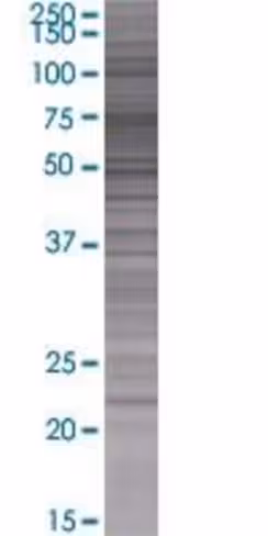 Popdc2 293t cell transient overexpr ession lysate (denatured) 100 µl