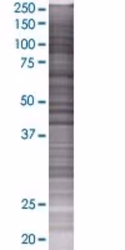 Osgepl1 293t cell transient overexp ression lysate (denatured) 100 µl