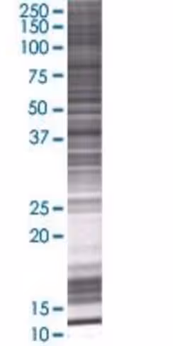 Pdlim2 293t cell transient overexpr ession lysate (denatured) 100 µl