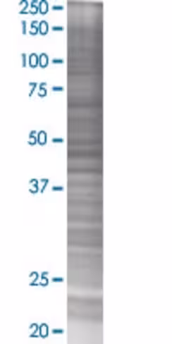 Rab17 293t cell transient overexpre ssion lysate (denatured) 100 µl