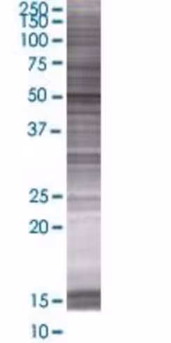Polr1e 293t cell transient overexpr ession lysate (denatured) 100 µl