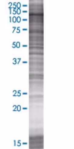 Plekhg2 293t cell transient overexp ression lysate (denatured) 100 µl