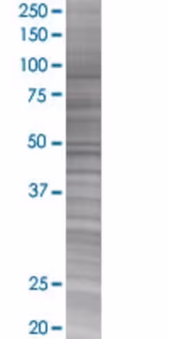 Pink1 293t cell transient overexpre ssion lysate (denatured) 100 µl