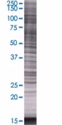 Pycrl 293t cell transient overexpre ssion lysate (denatured) 100 µl