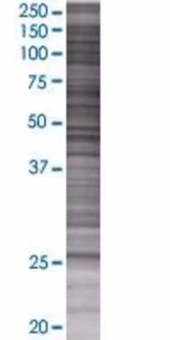 Otub2 293t cell transient overexpre ssion lysate (denatured) 100 µl
