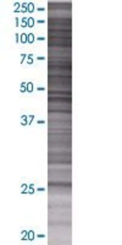 Otub2 293t cell transient overexpre ssion lysate (denatured) 100 µl