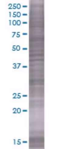 Pvrig 293t cell transient overexpre ssion lysate (denatured) 100 µl