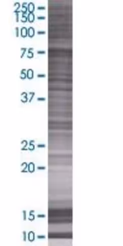 Aspscr1 293t cell transient overexp ression lysate (denatured) 100 µl
