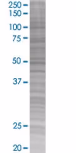 Aspscr1 293t cell transient overexp ression lysate (denatured) 100 µl
