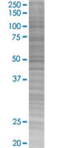 Aspscr1 293t cell transient overexp ression lysate (denatured) 100 µl