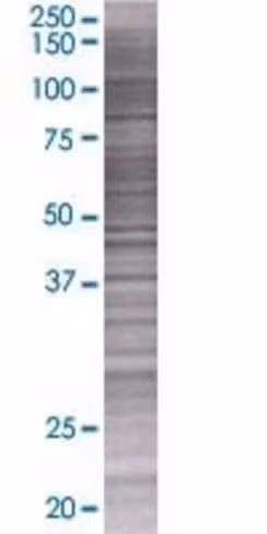 Pank3 293t cell transient overexpre ssion lysate (denatured) 100 µl