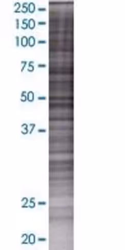 Plekhf2 293t cell transient overexp ression lysate (denatured) 100 µl