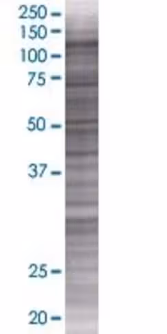 Parp8 293t cell transient overexpre ssion lysate (denatured) 100 µl