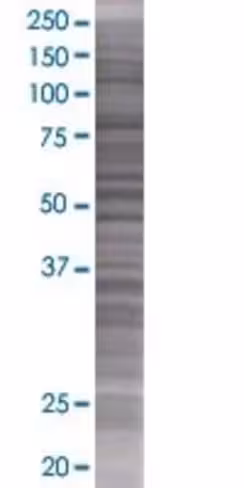Ogfod2 293t cell transient overexpr ession lysate (denatured) 100 µl