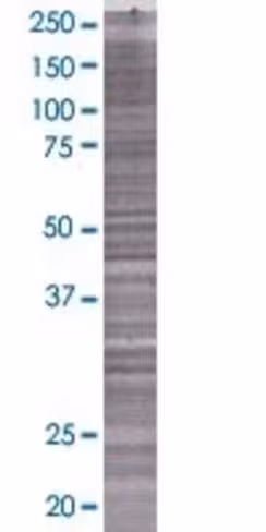 Qtrtd1 293t cell transient overexpr ession lysate (denatured) 100 µl