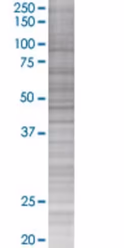 Pdzd3 293t cell transient overexpre ssion lysate (denatured) 100 µl