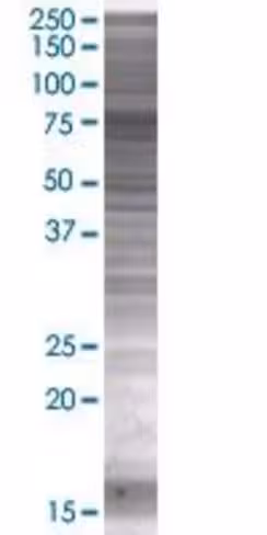 Rbm35b 293t cell transient overexpr ession lysate (denatured) 100 µl
