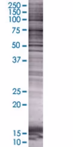 Ptges2 293t cell transient overexpr ession lysate (denatured) 100 µl