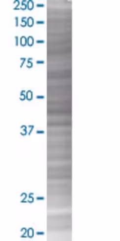 Ptges2 293t cell transient overexpr ession lysate (denatured) 100 µl