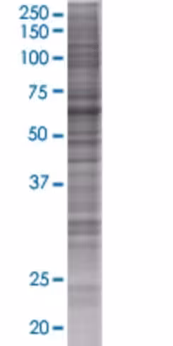 Plekhq1 293t cell transient overexp ression lysate (denatured) 100 µl