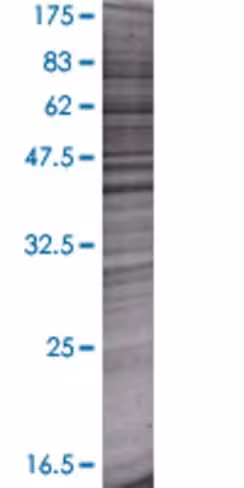 Pdgfd 293t cell transient overexpre ssion lysate (denatured) 100 µl