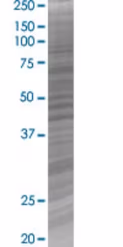 Pdgfd 293t cell transient overexpre ssion lysate (denatured) 100 µl