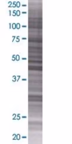 Pus1 293t cell transient overexpres sion lysate (denatured) 100 µl