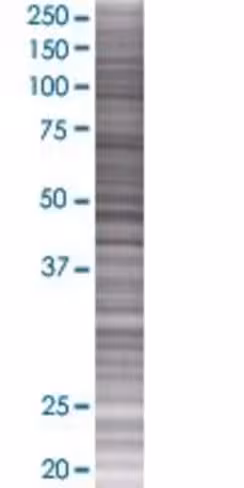 Pdrg1 293t cell transient overexpre ssion lysate (denatured) 100 µl