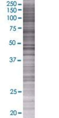 Atad3b 293t cell transient overexpr ession lysate (denatured) 100 µl