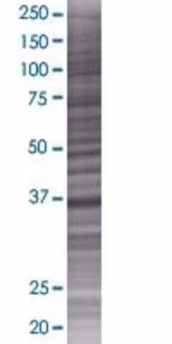 Rassf4 293t cell transient overexpr ession lysate (denatured) 100 µl