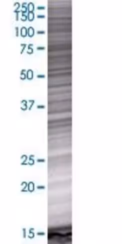 Pcgf6 293t cell transient overexpre ssion lysate (denatured) 100 µl