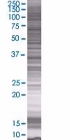 Phf6 293t cell transient overexpres sion lysate (denatured) 100 µl