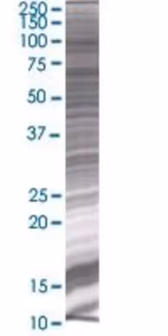 Pgbd1 293t cell transient overexpre ssion lysate (denatured) 100 µl