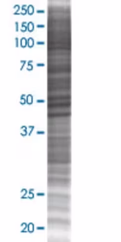 Raxl1 293t cell transient overexpre ssion lysate (denatured) 100 µl
