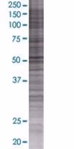 Rbm17 293t cell transient overexpre ssion lysate (denatured) 100 µl