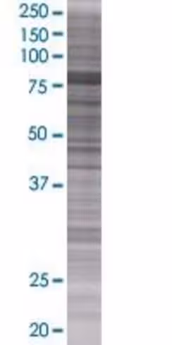 Reps1 293t cell transient overexpre ssion lysate (denatured) 100 µl