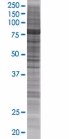 Reps1 293t cell transient overexpre ssion lysate (denatured) 100 µl
