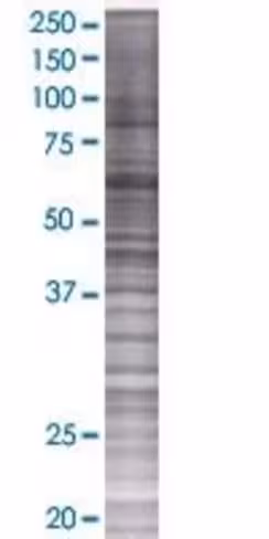 Ppil4 293t cell transient overexpre ssion lysate (denatured) 100 µl