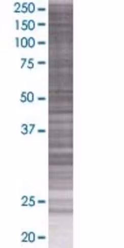 Otop2 293t cell transient overexpre ssion lysate (denatured) 100 µl