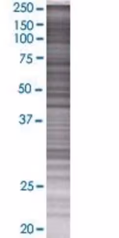 Ppp1r14a 293t cell transient overex pression lysate(denatured) 100 µl