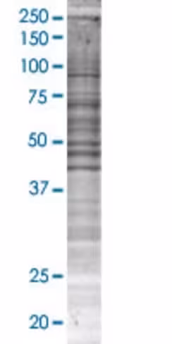 Ppp1r14a 293t cell transient overex pression lysate(denatured) 100 µl