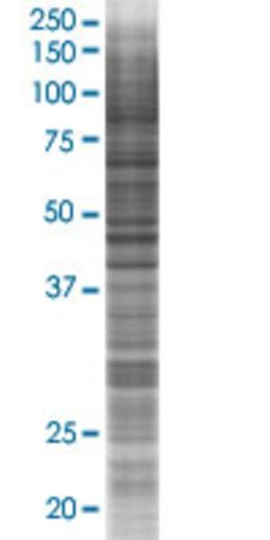 Prrt2 293t cell transient overexpre ssion lysate (denatured) 100 µl