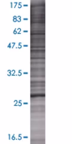 Rdh13 293t cell transient overexpre ssion lysate (denatured) 100 µl