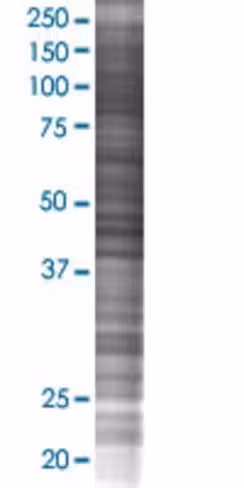 Phf21b 293t cell transient overexpr ession lysate (denatured) 100 µl