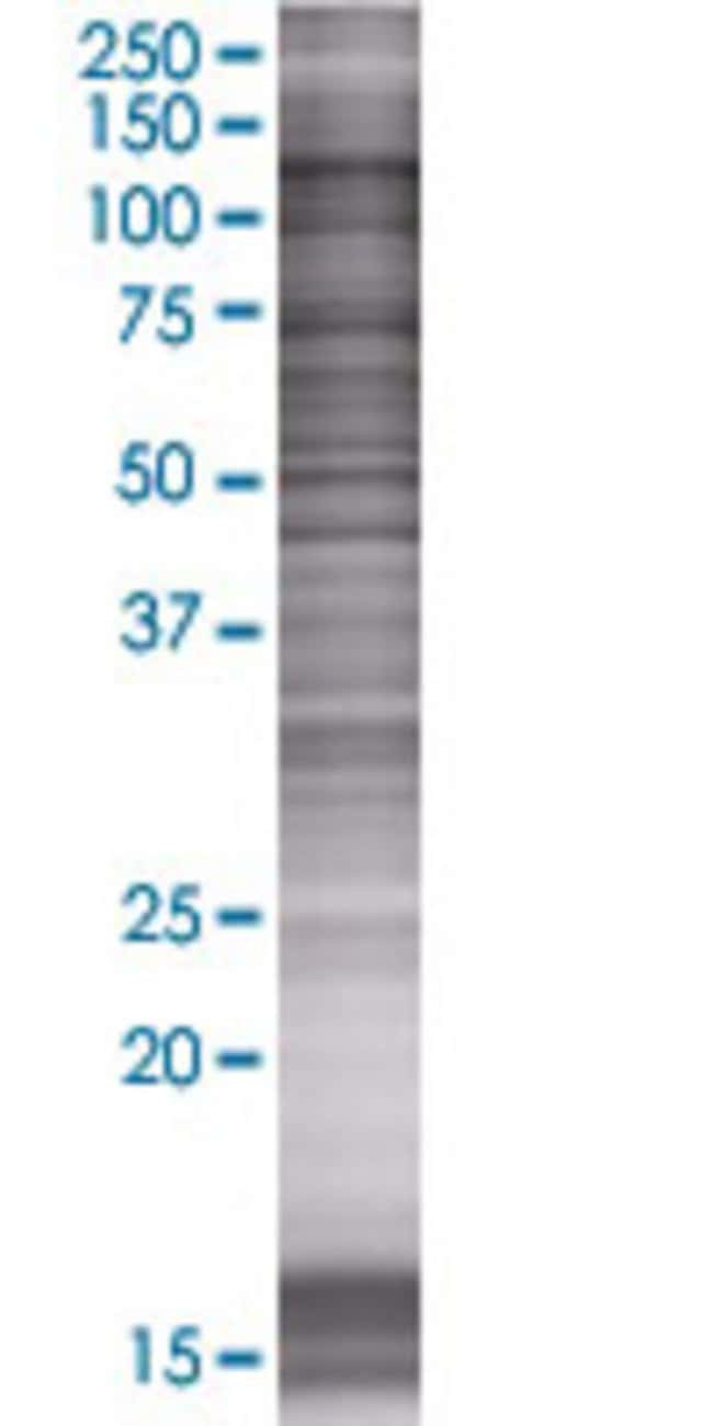 Osbpl5 293t cell transient overexpr ession lysate (denatured) 100 µl