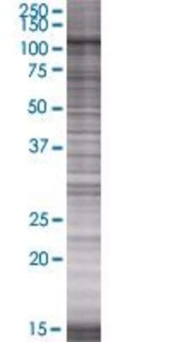 Osbpl8 293t cell transient overexpr ession lysate (denatured) 100 µl