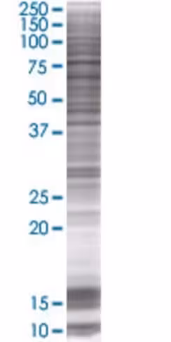 Osbpl10 293t cell transient overexp ression lysate (denatured) 100 µl
