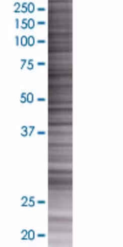 Olig1 293t cell transient overexpre ssion lysate (denatured) 100 µl