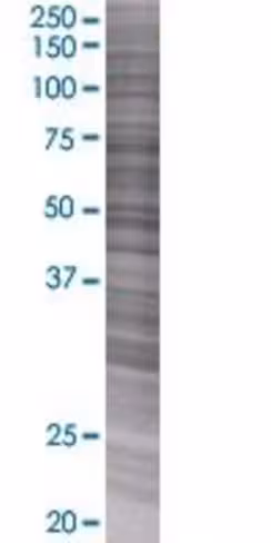 Art5 293t cell transient overexpres sion lysate (denatured) 100 µl