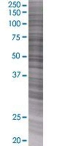 Art5 293t cell transient overexpres sion lysate (denatured) 100 µl